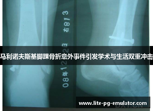 马利诺夫斯基脚踝骨折意外事件引发学术与生活双重冲击
